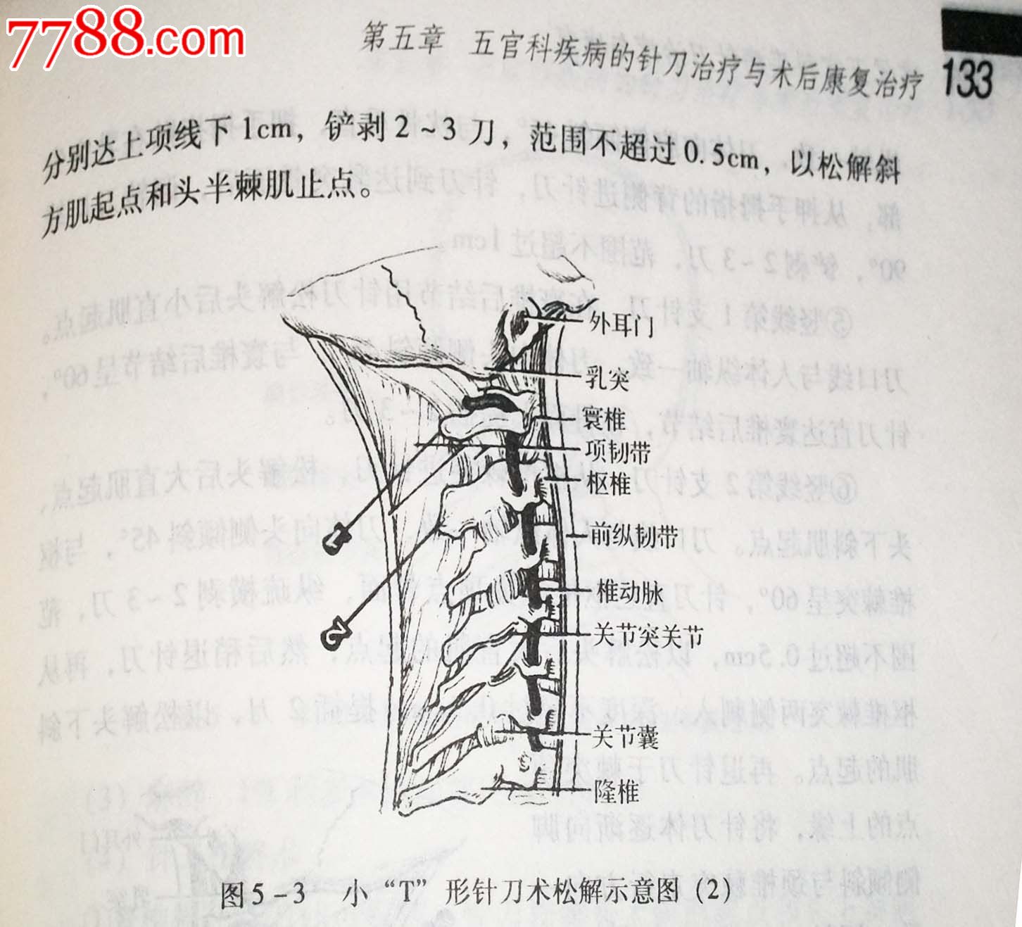 常见五官科疾病针刀治疗与康复主编:张天民 专科专病针刀治疗与康复