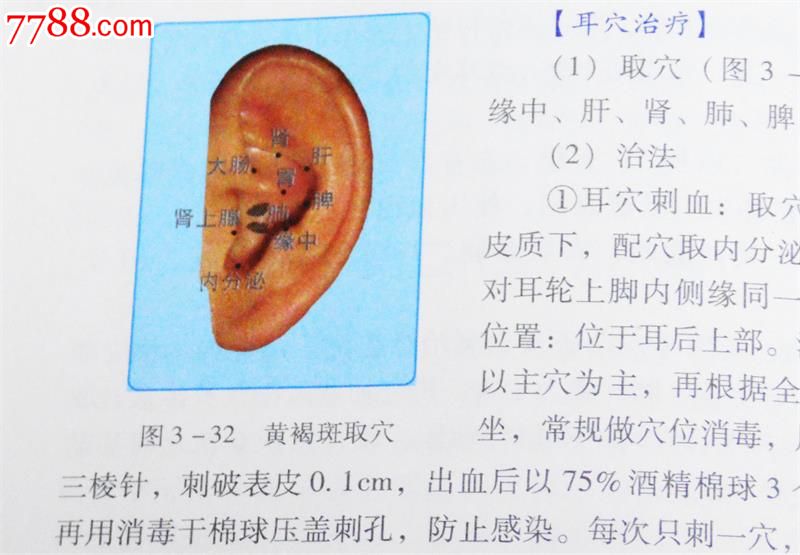 轻松速学中医特色疗法丛书:图解耳针疗法郭长