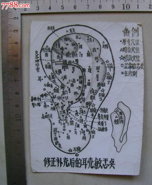 耳朵穴位-敏感点图片-价格:5元-se24406523-老照片-零售-中国收藏热线